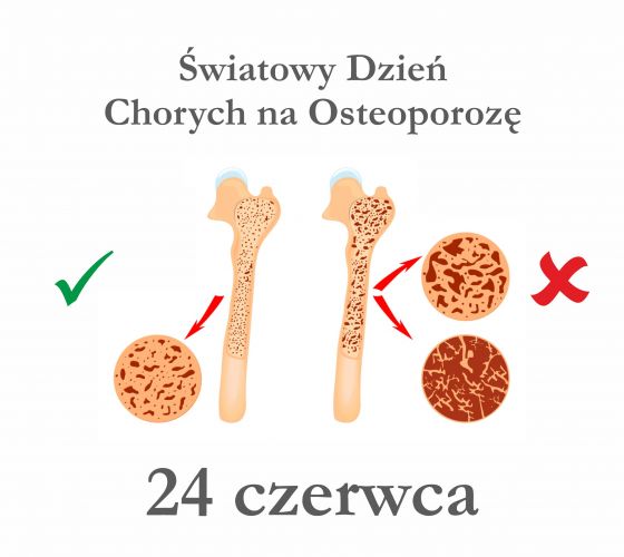 Всемирный день борьбы с остеопорозом